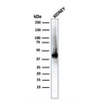 Western blot testing of human kidney lysate with recombinant AMACR/p504S antibody (clone rAMACR/1864). Predicted molecular weight ~43 kDa.