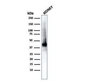 Western blot testing of human kidney lysate with recombinant AMACR/p504S antibody (clone rAMACR/1864). Predicted molecular weight ~43 kDa.