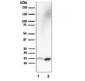 Western blot testing of human 1) HepG2 and 2) kidney lysate with FABP1 antibody. Predicted molecular weight: ~14 kDa.