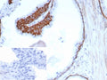 IHC staining of FFPE human prostate tissue with CK13 antibody (clone KRT13/8577R). Inset: PBS used in place of primary Ab (secondary Ab negative control). HIER: boil tissue sections in pH 9 10mM Tris with 1mM EDTA for 20 min and allow to cool before testing.