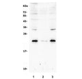 Western blot testing of human 1) Caco-2, 2) HepG2 and 3) A549 cell lysate with Rab8 antibody. Predicted molecular weight: ~24 kDa.