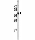 Western blot analysis of LOX antibody and MDA-MB468 lysate. Expected molecular weight: ~47 kDa (unprocessed/unmodified), ~50 kDa (glycosylated), ~32 kDa (processed form).