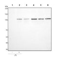 Western blot testing of human 1) ThP-1 without LPS treatment, 2) ThP-1 with LPS treatment, 3) HaCaT, 4) PC-3, 5) Caco-2 and 6) HepG2 cell lysate with TLR2 antibody. Predicted molecular weight: 85-90 kDa.