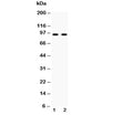 Western blot testing of Cadherin 17 antibody and 1) human HeLa and 2) human SW620 cell lysate. Predicted molecular weight ~92 kDa but may be observed at higher molecular weights due to glycosylation.