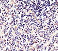 IHC testing of FFPE human thymus tissue with LCK antibody. HIER: steam section in pH6 citrate buffer for 20 min and allow to cool prior to staining.
