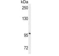 Western blot testing of mouse cerebellum tissue lysate with ENPP2 antibody. Expected molecular weight: 99-125 kDa depending on glycosylation level.