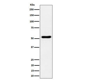 Western blot testing of human Jurkat cell lysate with GPRC5B antibody. Predicted molecular weight ~45 kDa but may be observed at higher molecular weights due to glycosylation.