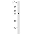 Western blot testing of human MOLT4 cell lysate with ALKBH6 antibody. Predicted molecular weight ~26 kDa.