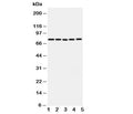 Western blot testing of ABCG1 antibody and Lane 1: U87; 2: SMMC-7721; 3: HeLa; 4: COLO320; 5: MCF-7 cell lysate. Predicted molecular weight: 75~90KD