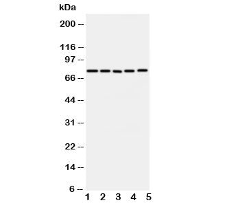Western blot testing of ABCG1 antibody and Lane 1: U87; 2: SMMC-7721; 3: HeLa; 4: COLO320; 5: MCF-7 cell lysate. Predicted molecular weight: 75~90KD