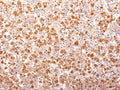 IHC: Formalin-fixed, paraffin-embedded human pituitary gland stained with ACTH antibody (AH26 + 57). Required HIER: boil tissue sections in 10mM Citrate Buffer, pH 6.0, for 10-20 min followed by cooling at RT for 20 minutes.