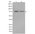 Western blot testing of human 1) HepG2 and 2) JAr cell lysate with ALPL antibody. Predicted molecular weight ~57 kDa, but can be observed at up to ~75 kDa due to glycosylation.