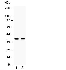 Western blot testing of HSD17B6 antibody and Lane 1: human placenta; 2: MCF-7; Predicted/observed molecular weight: ~35kDa.