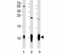 Western blot analysis of lysate from (1) A431 cell line, (2) mouse brain and (3) rat brain tissue using S100B antibody at 1:1000. Predicted size: 11 kDa with a 21 kDa homodimer