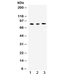 Western blot testing of 1) rat kidney, 2) mouse spleen and 3) human Jurkat lysate with Cyclin T1 antibody at 0.5ug/ml. Predicted/observed molecular weight ~81 kDa.