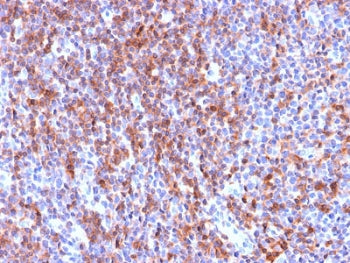 IHC staining of FFPE human tonsil tissue with recombinant ICAM3 antibody (clone ICAM3/2873R). HIER: boil tissue sections in pH6, 10mM citrate buffer, for 10-20 min followed by cooling at RT for 20 min.