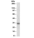 Western blot testing of human skeletal muscle lysate with FHL3 antibody at 1ug/ml. Predicted molecular weight: ~31 kDa, can also be observed at 33-34 kDa.