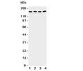 Western blot testing of cPLA2 antibody and Lane 1: rat testis; 2: (r) brain; 3: human A549; 4: (h) COLO320 cell lysate. Expected size 85~110KD, observed here at ~160KD