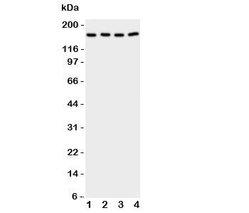 Western blot testing of cPLA2 antibody and Lane 1: rat testis; 2: (r) brain; 3: human A549; 4: (h) COLO320 cell lysate. Expected size 85~110KD, observed here at ~160KD