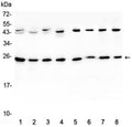 Western blot testing of 1) rat brain, 2) rat lung, 3) mouse brain, 4) mouse lung and human 5) HeLa, 6) placenta, 7) MCF7 and 8) HepG2 lystate with IL36A antibody at 0.5ug/ml. Predicted molecular weight ~17 kDa, routinely observed at 18-22 kDa.