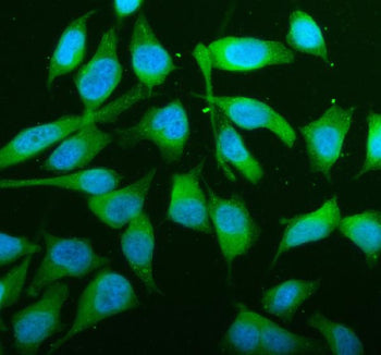 Western blot testing of human 1) HeLa and 2) COLO320 cell lysate with JNK2 antibody. Expected/observed molecular weight ~48 kDa.