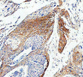 Immunofluorescent staining of FFPE human U-2 OS cells with Connexin 43 antibody (green) and DAPI (blue). HIER: boil tissue sections in pH6, 10mM citrate buffer, for 20 min and allow to cool before testing.