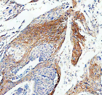 Immunofluorescent staining of FFPE human U-2 OS cells with Connexin 43 antibody (green) and DAPI (blue). HIER: boil tissue sections in pH6, 10mM citrate buffer, for 20 min and allow to cool before testing.