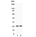 Western blot testing of CD3 epsilon antibody and Lane 1: Jurkat; 2: CEM lysate. Expected/observed molecular weight ~23 kDa.