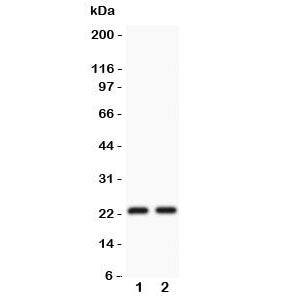 Western blot testing of CD3 epsilon antibody and Lane 1: Jurkat; 2: CEM lysate. Expected/observed molecular weight ~23 kDa.