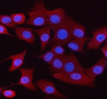 Immunofluorescent staining of Synaptogyrin 1 using anti-Synaptogyrin 1 antibody (red). Synaptogyrin 1 was detected in an immunocytochemical section of cells. Enzyme antigen retrieval was performed using IHC enzyme antigen retrieval reagent for 15 mins. The cells were blocked with 10% goat serum. And then incubated with 5 ug/ml rabbit anti-Synaptogyrin 1 antibody overnight at 4oC. Cy3 Conjugated Goat Anti-Rabbit IgG was used as secondary antibody at 1:500 dilution and incubated for 30 min at 37oC.