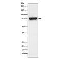 Western blot testing of human HeLa cell lysate with MTA2 antibody. Predicted molecular weight ~75 kDa.