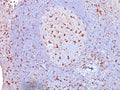 IHC: Formalin-fixed, paraffin-embedded human tonsil stained with anti-CD68 antibody (clone SPM130).