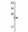 Western blot analysis of MCT-1 antibody and mouse bladder tissue lysate