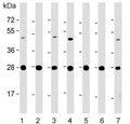 Western blot testing of human 1) HeLa, 2) Jurkat, 3) K562, 4) HepG2, 5) SH-SY5Y, 6) rat brain and 7) mouse brain lysate with HSD17B10 antibody. Predicted molecular weight ~27 kDa.