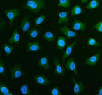 Immunofluorescent staining of PLS3 using anti-PLS3 antibody (green). PLS3 was detected in an immunocytochemical section of cells. Enzyme antigen retrieval was performed using IHC enzyme antigen retrieval reagent for 15 mins. The cells were blocked with 10% goat serum. And then incubated with 5 ug/ml rabbit anti-PLS3 antibody overnight at 4oC. DyLight 488 Conjugated Goat Anti-Rabbit IgG was used as secondary antibody at 1:500 dilution and incubated for 30 min at 37oC.