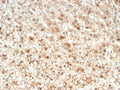 IHC staining of FFPE human kidney tissue with IL-18 antibody (clone IL18/4624) at 2ug/ml. HIER: boil tissue sections in pH 9 10mM Tris with 1mM EDTA for 20 min and allow to cool before testing.