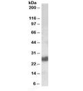 Western blot testing of human tonsil lysate with CD90 antibody at 0.1ug/ml. Predicted molecular weight 18~35kDa depending on glycosylation level.