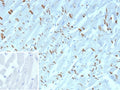 IHC staining of FFPE human heart tissue with Cadherin 2 antibody (clone CDH2/9489). Inset: PBS used in place of primary Ab (secondary Ab negative control). HIER: boil tissue sections in pH 9 10mM Tris with 1mM EDTA for 20 min and allow to cool before testing.