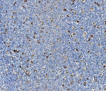 IHC staining of FFPE human tonsil with Niemann Pick C2 antibody. HIER: boil tissue sections in pH8 EDTA for 20 min and allow to cool before testing.