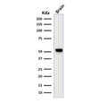 Western blot testing of human brain lysate with recombinant Glial Fibrillary Acidic Protein antibody (clone rASTRO/789). Predicted molecular weight ~50 kDa.
