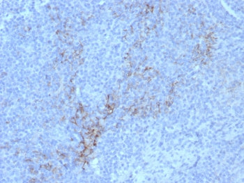 IHC staining of FFPE human lymph node tissue with CD10 antibody (clone rMME/8584). HIER: boil tissue sections in pH 9 10mM Tris with 1mM EDTA for 20 min and allow to cool before testing.