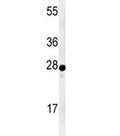 Western blot analysis of AANAT antibody and human Y79 lysate. Predicted molecular weight ~23 kDa.