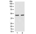 Western blot testing of human 1) A431 and 2) MCF7 lysate with Alpha Actin antibody at 0.5ug/ml. Expected molecular weight: 42-45 kDa.
