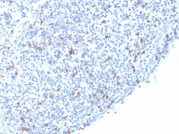 IHC staining of FFPE human tonsil with recombinant ITGAE antibody (clone rITGAE/2063). HIER: boil tissue sections in pH 9 10mM Tris with 1mM EDTA for 20 min and allow to cool before testing.