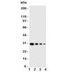 Western blot testing of LTK antibody and human recombinant protein; Lane 1: 10ng;  2: 5ng; 3: 2.5ng; 4: 1.25ng