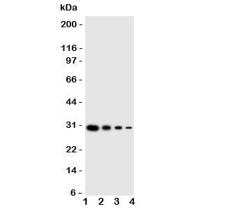 Western blot testing of LTK antibody and human recombinant protein; Lane 1: 10ng;  2: 5ng; 3: 2.5ng; 4: 1.25ng