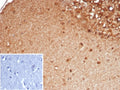 IHC staining of FFPE human brain tissue with SLC18A2 antibody (clone SLC18A2/7983). Inset: PBS used in place of primary Ab (secondary Ab negative control). HIER: boil tissue sections in pH 9 10mM Tris with 1mM EDTA for 20 min and allow to cool before testing.