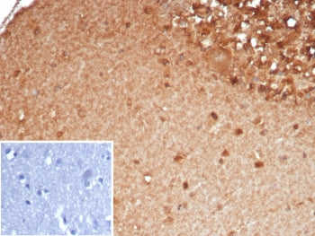 IHC staining of FFPE human brain tissue with SLC18A2 antibody (clone SLC18A2/7983). Inset: PBS used in place of primary Ab (secondary Ab negative control). HIER: boil tissue sections in pH 9 10mM Tris with 1mM EDTA for 20 min and allow to cool before testing.