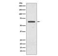 Western blot testing of human 293T cell lysate with Glutaminase antibody. Predicted molecular weigh: 65-73 kDa.
