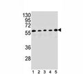 PAX1 antibody western blot analysis in (1) HepG2, (2) MDA-MB453, (3) 293, (4) K562 and (5) MCF-7 lysate. Predicted size 45~55 kDa